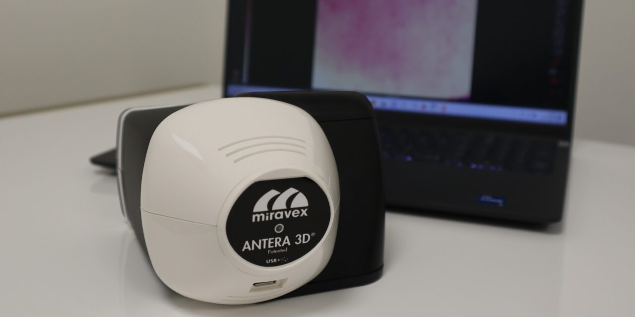 Miravex Antera 3D – a device for analyzing and assessing the condition of the skin.