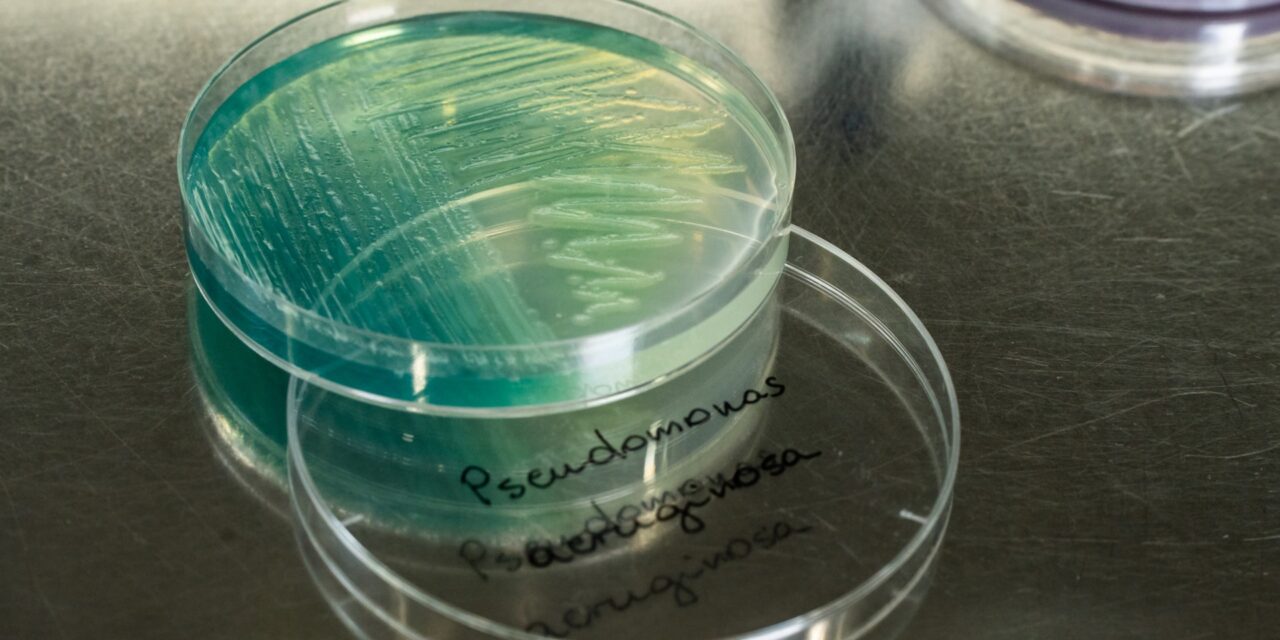 Śledzenie drobnoustrojów: identyfikacja bakterii w zakładzie produkcyjnym.